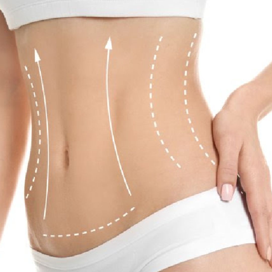Best Body Sculpture Treatment Fleetwood